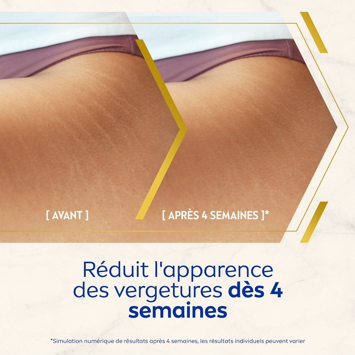 NIVEA Luminous 630 - Huile Sérum Corps Anti-ve rgetures