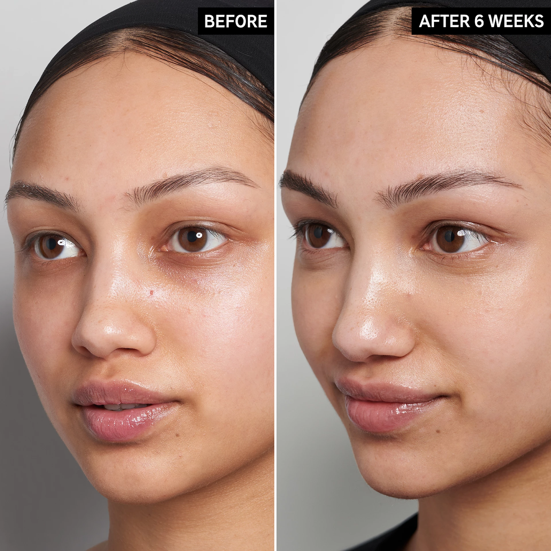Serum s 15% vitamina C i EGF-a - INKEY lista