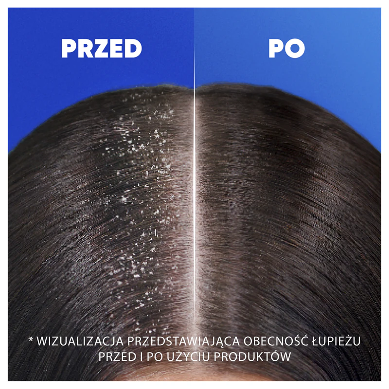 Shampoo Anticaspa Head & Shoulders Hidratante