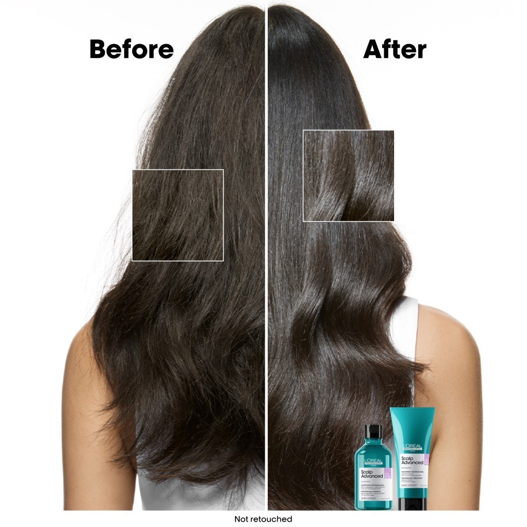 L'Oréal Professionnel šampon za kosu Skalp Advanced Anti-Discomfort Dermo-Regulator - 300 ml