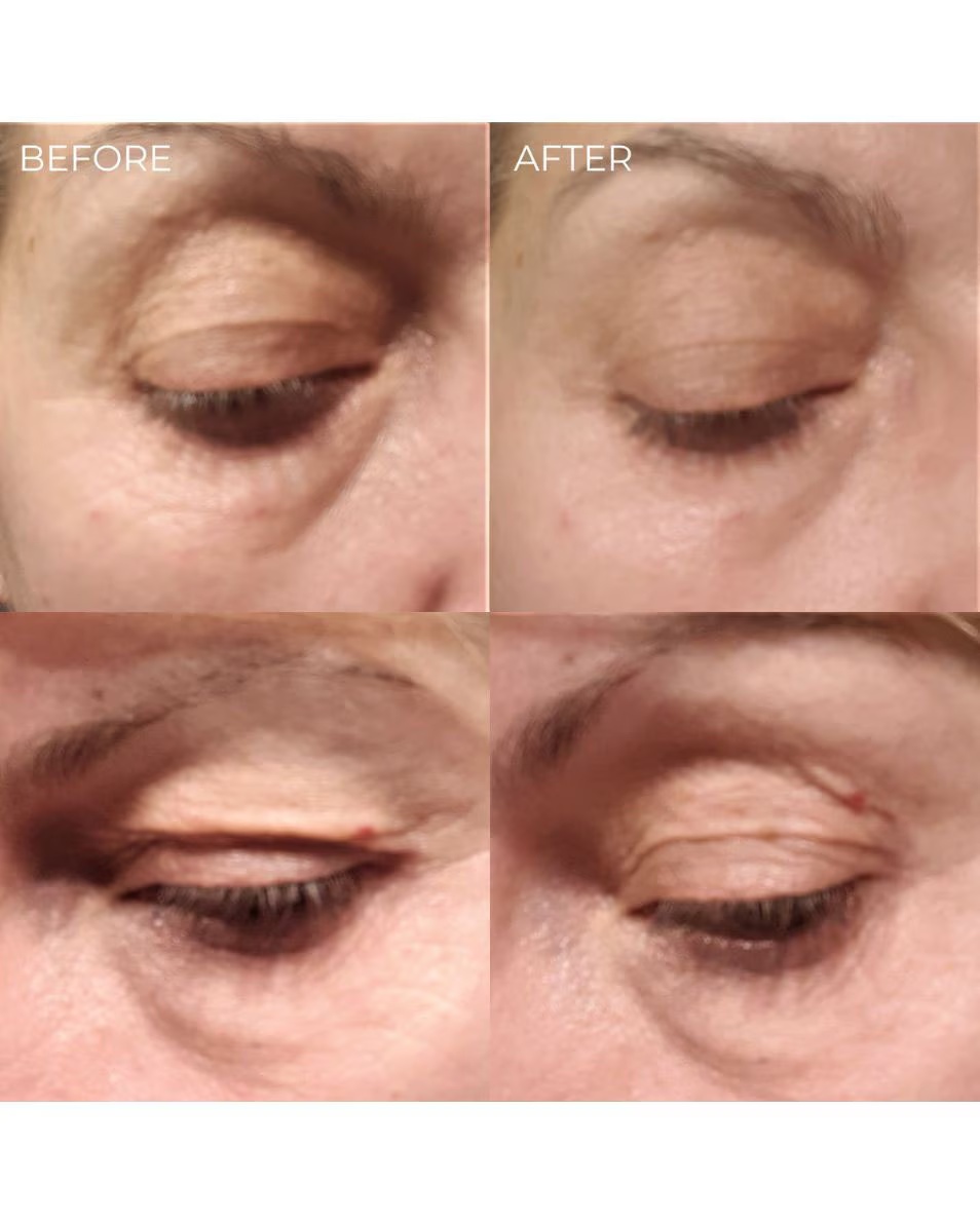 SER LIFTING INSTANTANEU BEAUTY REDUCEREA LINIILE FINE ȘI A RIDURILOR