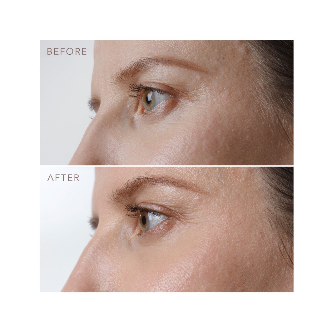 FOREO serum za oči IRIS™ učvršćujući PM serum za oči – 15 ml