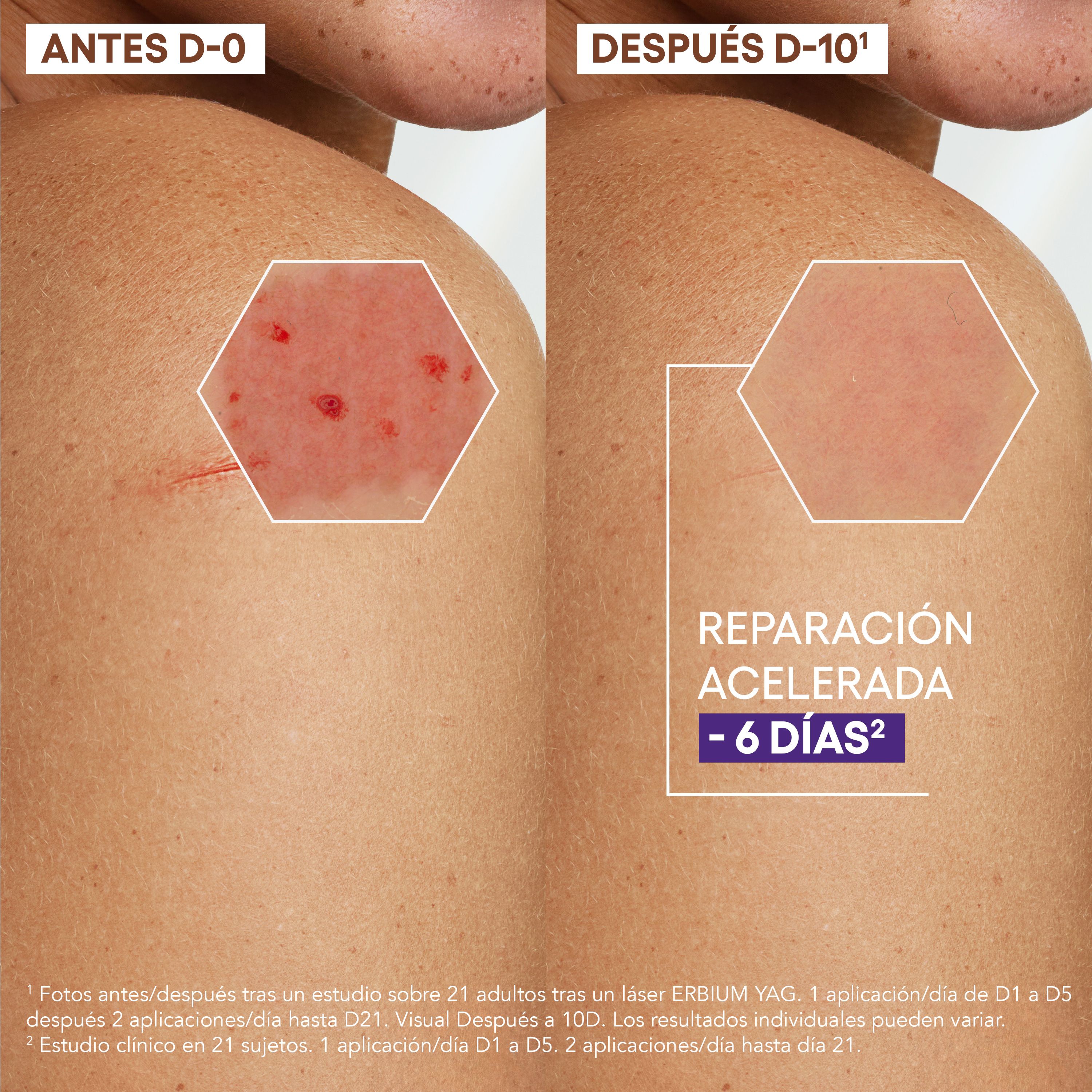Epitheliale AH Ultra Soothing Repair Cream Liečba z lekárne