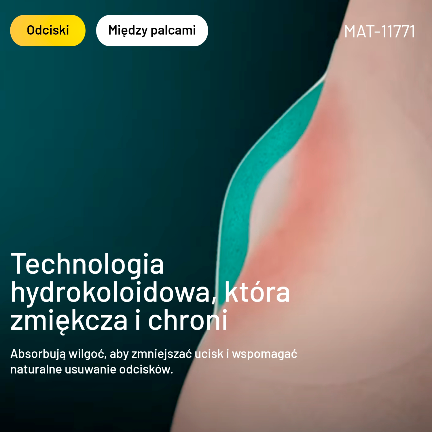 Compeed
