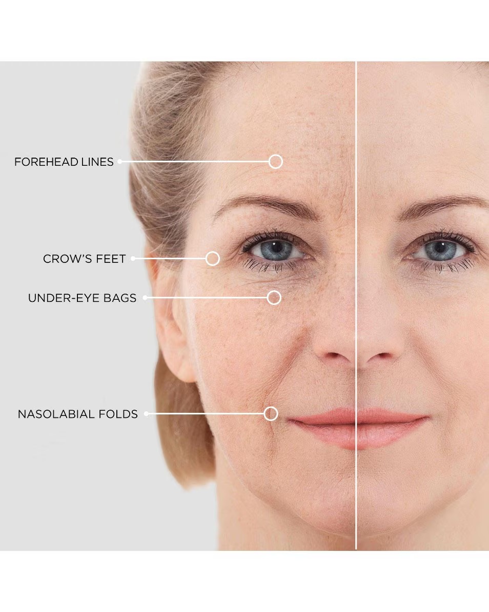 SER LIFTING INSTANTANEU BEAUTY REDUCEREA LINIILE FINE ȘI A RIDURILOR