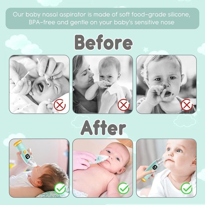 Aspirador nasal eléctrico, aspirador nasal para bebés, limpiador nasal automático, 3 velocidades, antirreflujo, con música y luz.