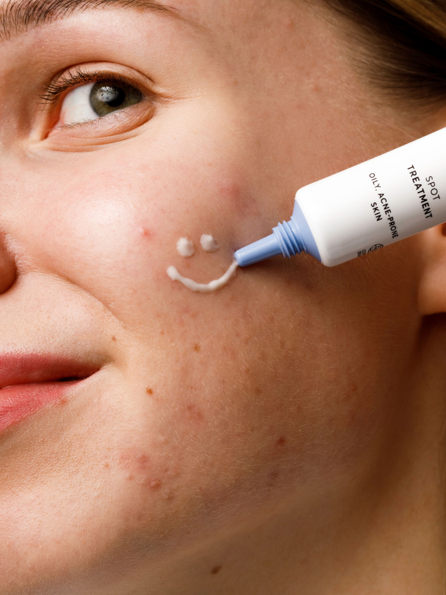 Mossa by Madara Acne Act