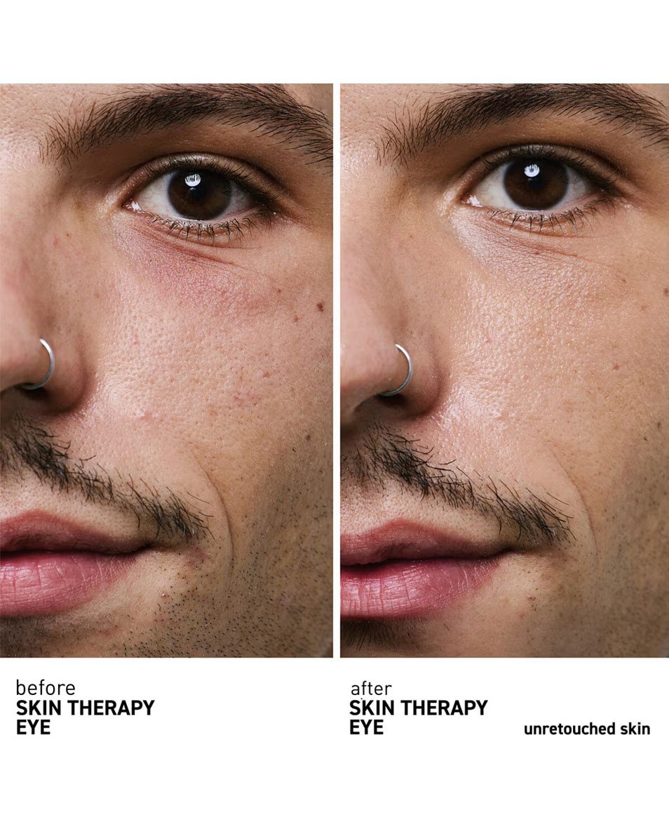 ERBORIAN Skin Therapy Eye Cremă contur ochi multi-perfecționare