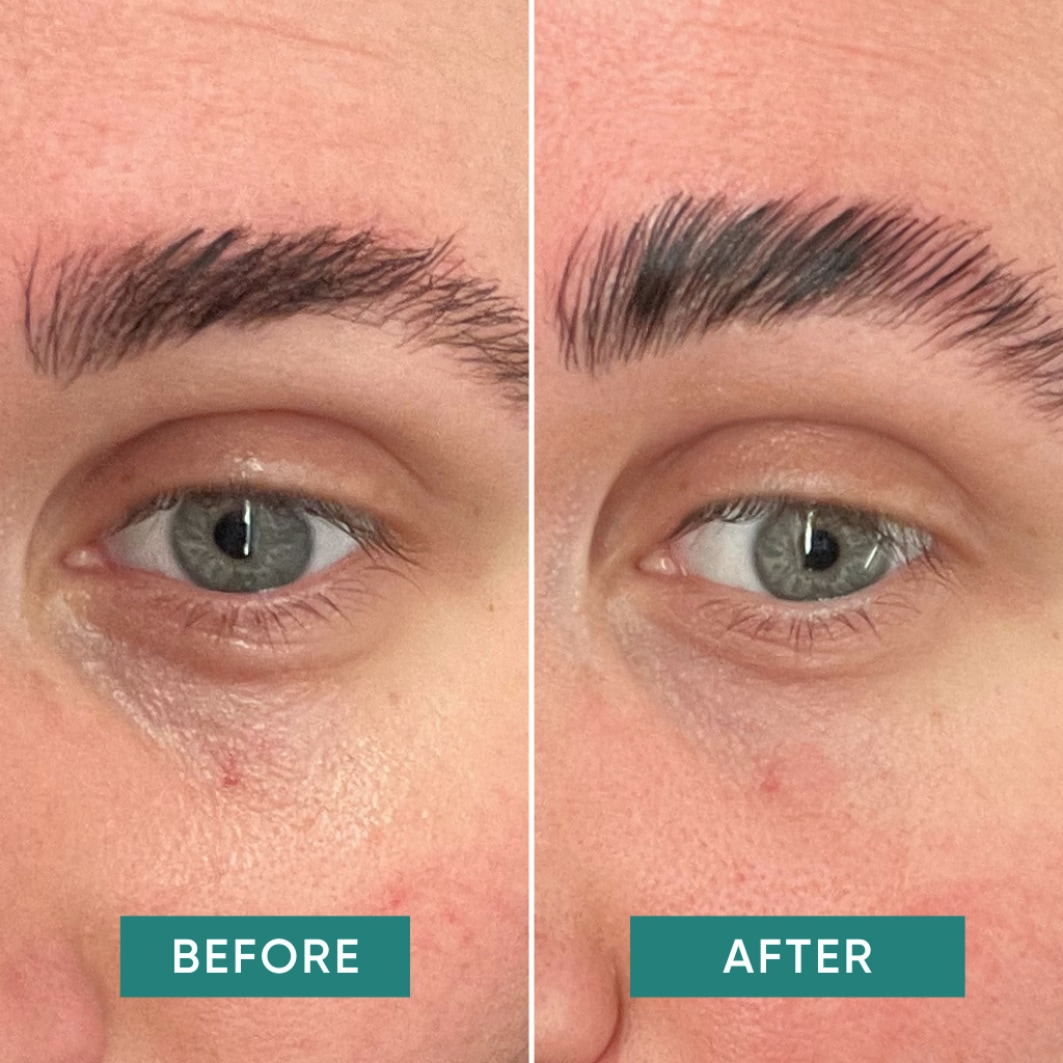 Máscara para os olhos de damasco, compressas reutilizáveis para os olhos com vitamina C – 2 g