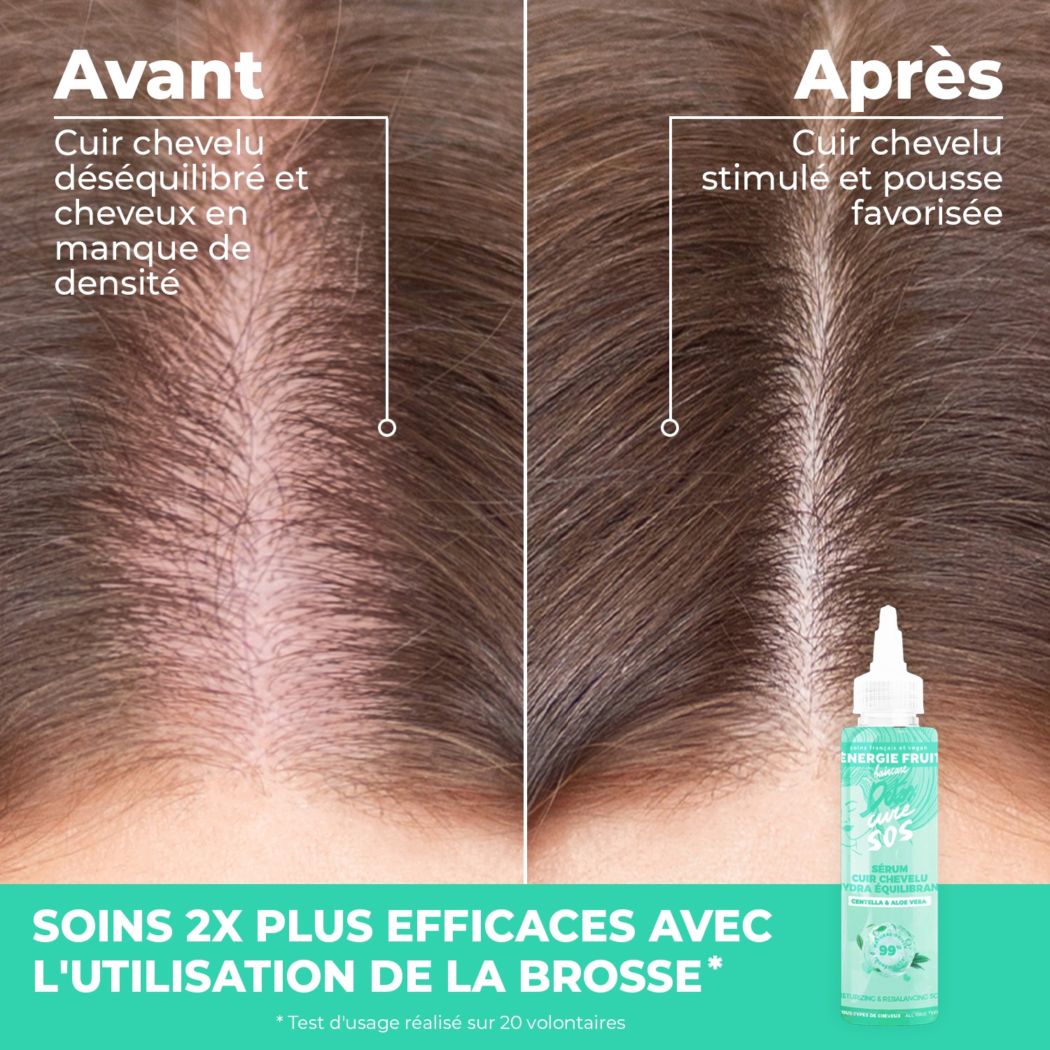 Energie Fruit BROSSE CUIR CHEVELU MASSANTE DETOX