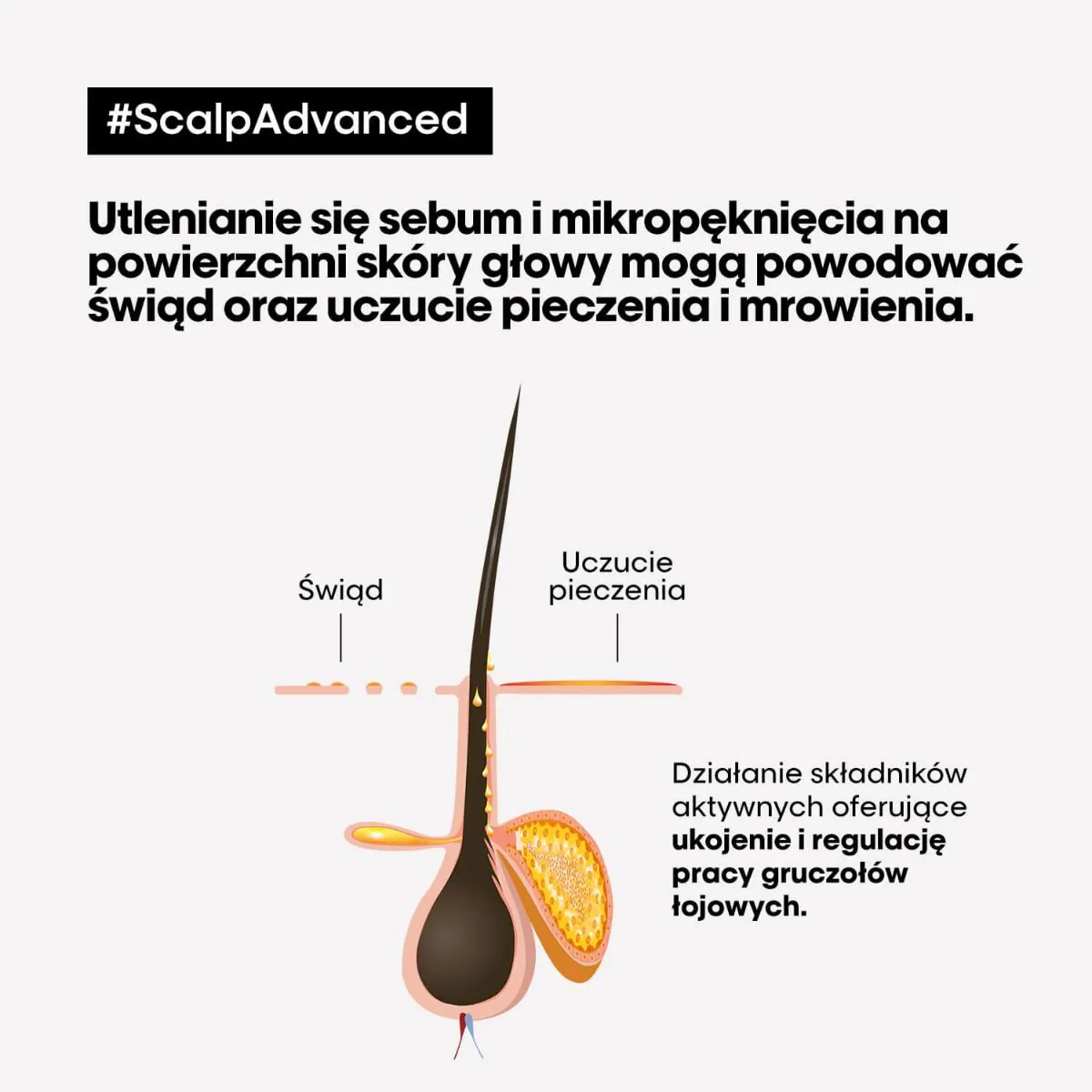 L’Oréal Professionnel Paris Krem kojący Scalp Advanced