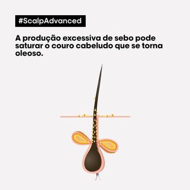 L'Oréal Professionnel Serie Expert Scalp Advanced Pelliculaire Schampo Lugnande torr och fet hårbotten Anti-mjällschampo 500 ml 500 ml