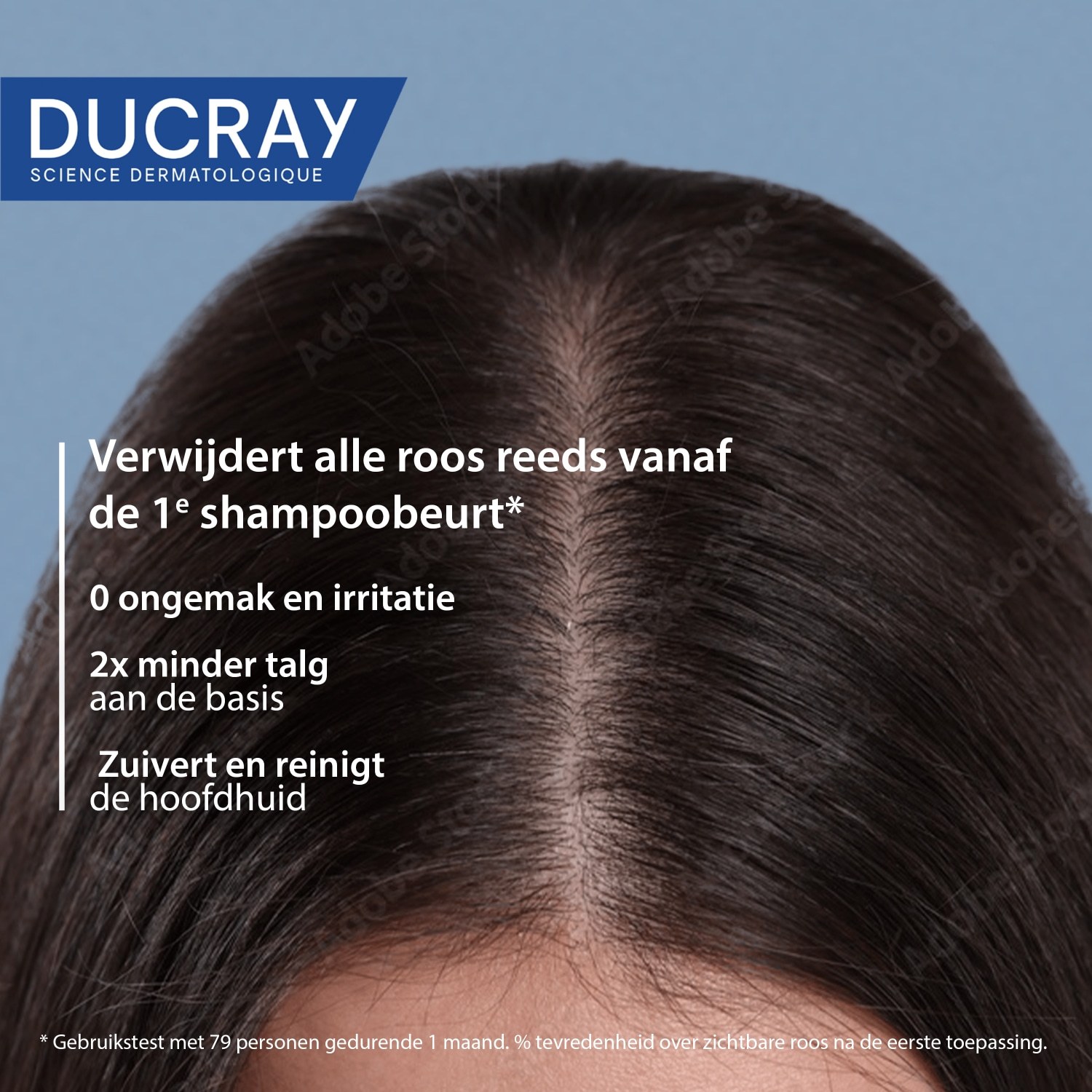 Ducray KELUAL SQUANORM regulirajući šampon za njegu - 200 ml