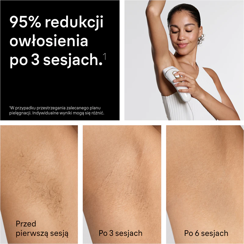 Braun IPL Silk·expert Pro 5 PL5221: aparelho inteligente de depilação a laser para corpo, rosto, virilha e axilas.