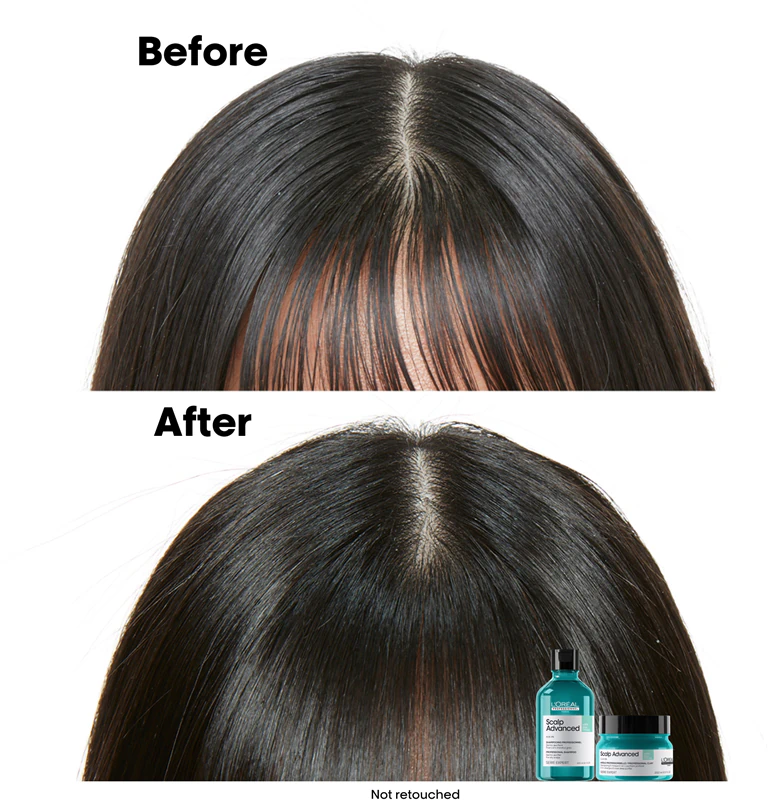 Shampoo de limpeza avançada L'Oréal Professionnel Serie Expert Scalp para couro cabeludo oleoso