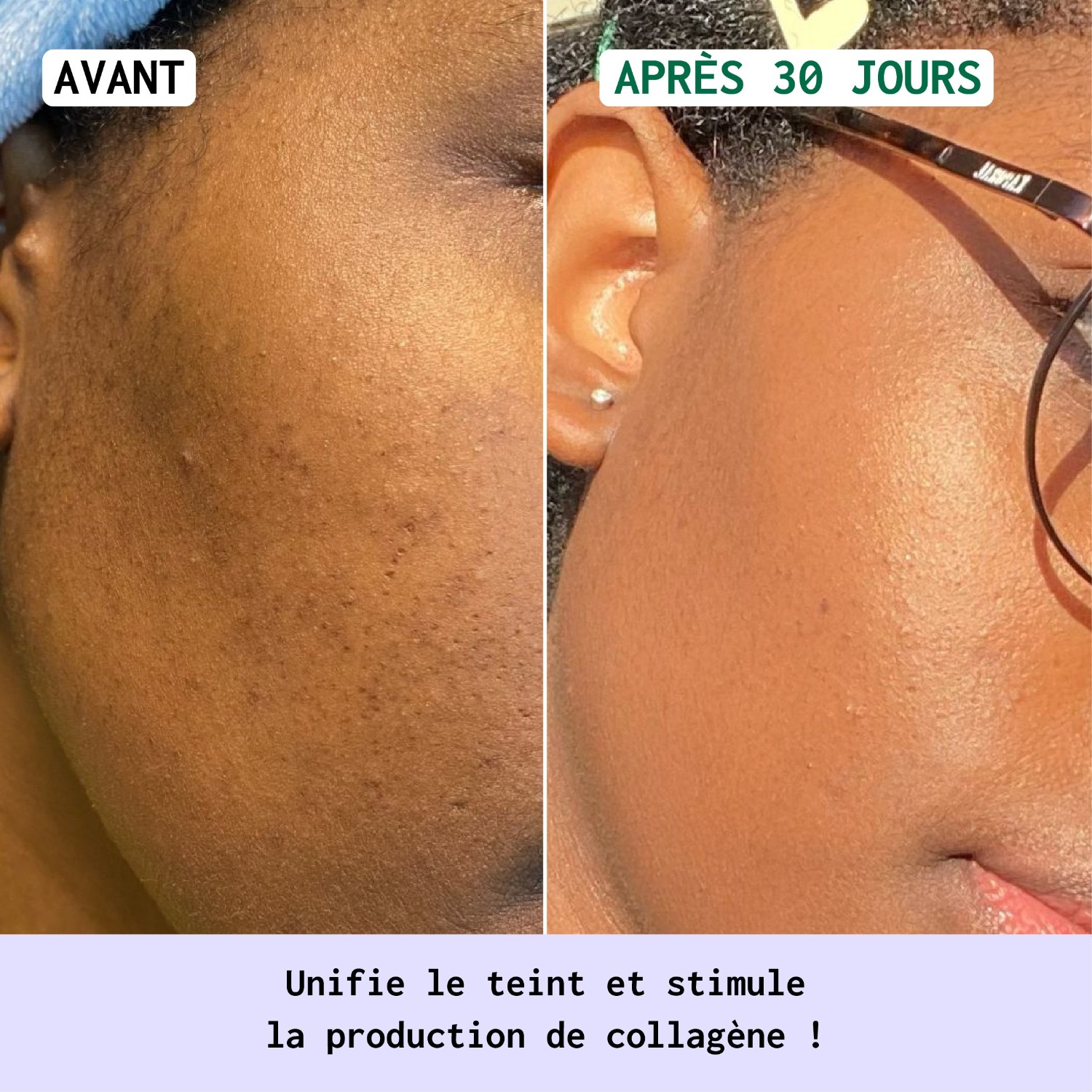 Nubiance Soin Nuit Anti-taches HRB-3