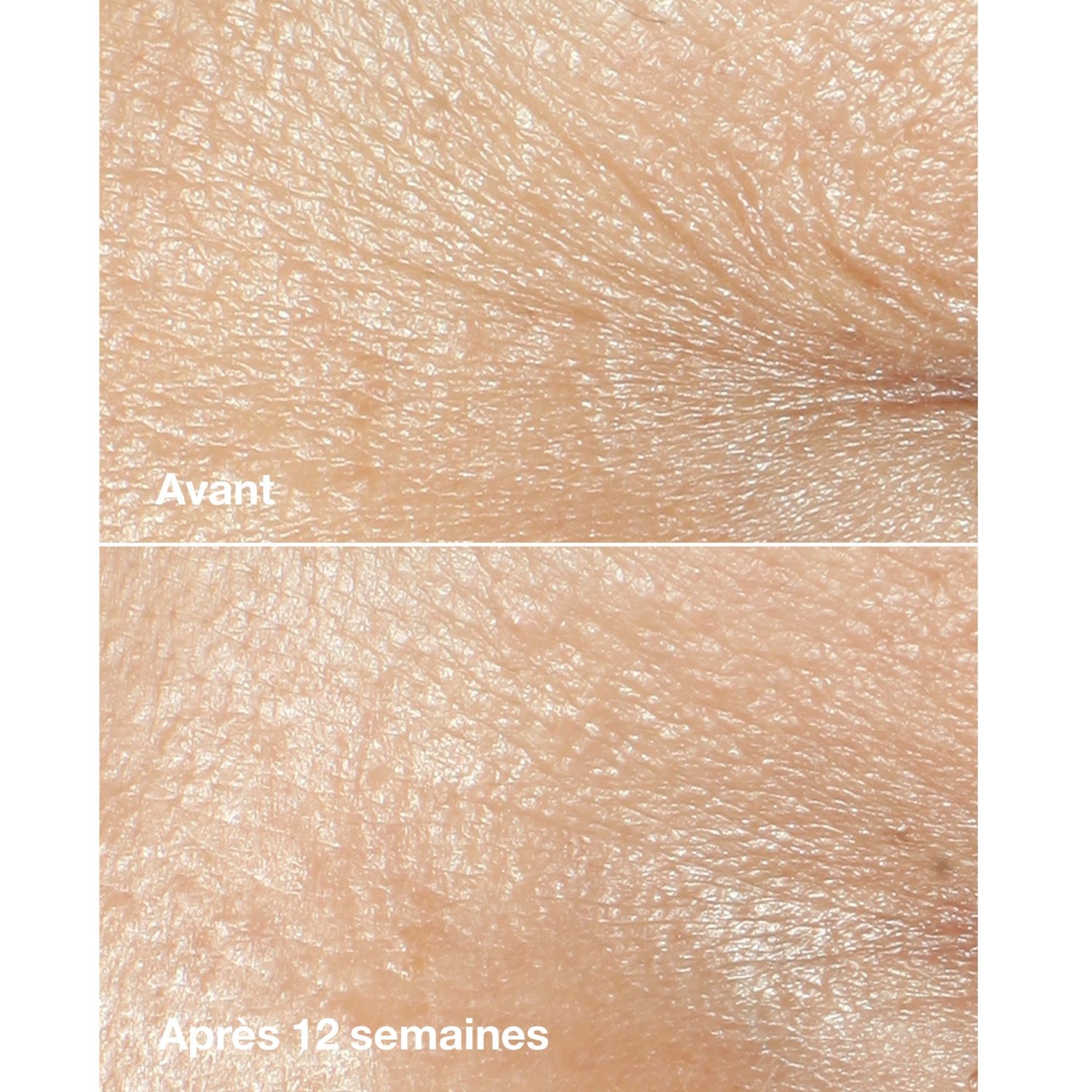 Clinique Crème riche correctrice anti-rides