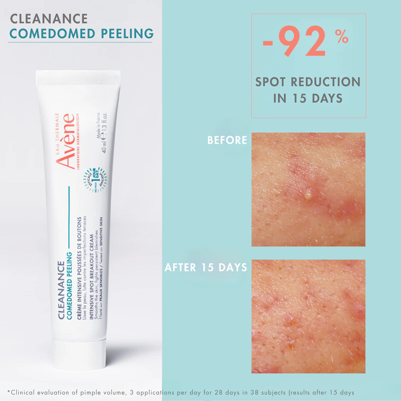 Avène Cleanance Creme Peeling Intensivo para Pele com Tendência à Acne