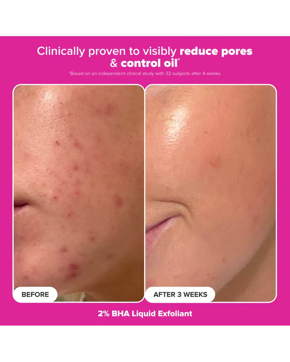 Paula's Choice MINI RINKINYS Putlios ir švytinčios odos rinkinys