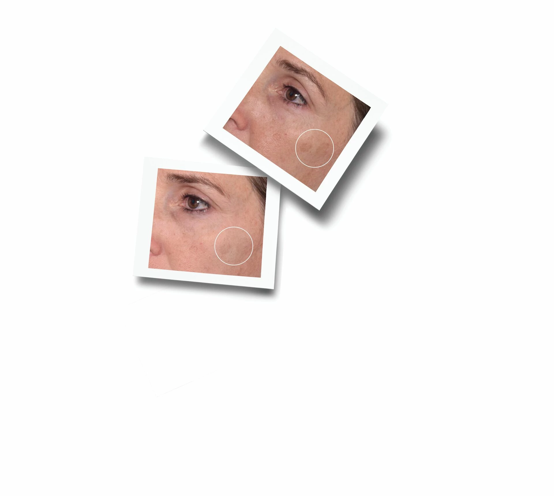 Ser corector rapid pentru pete închise la culoare 30 ml - Murad
