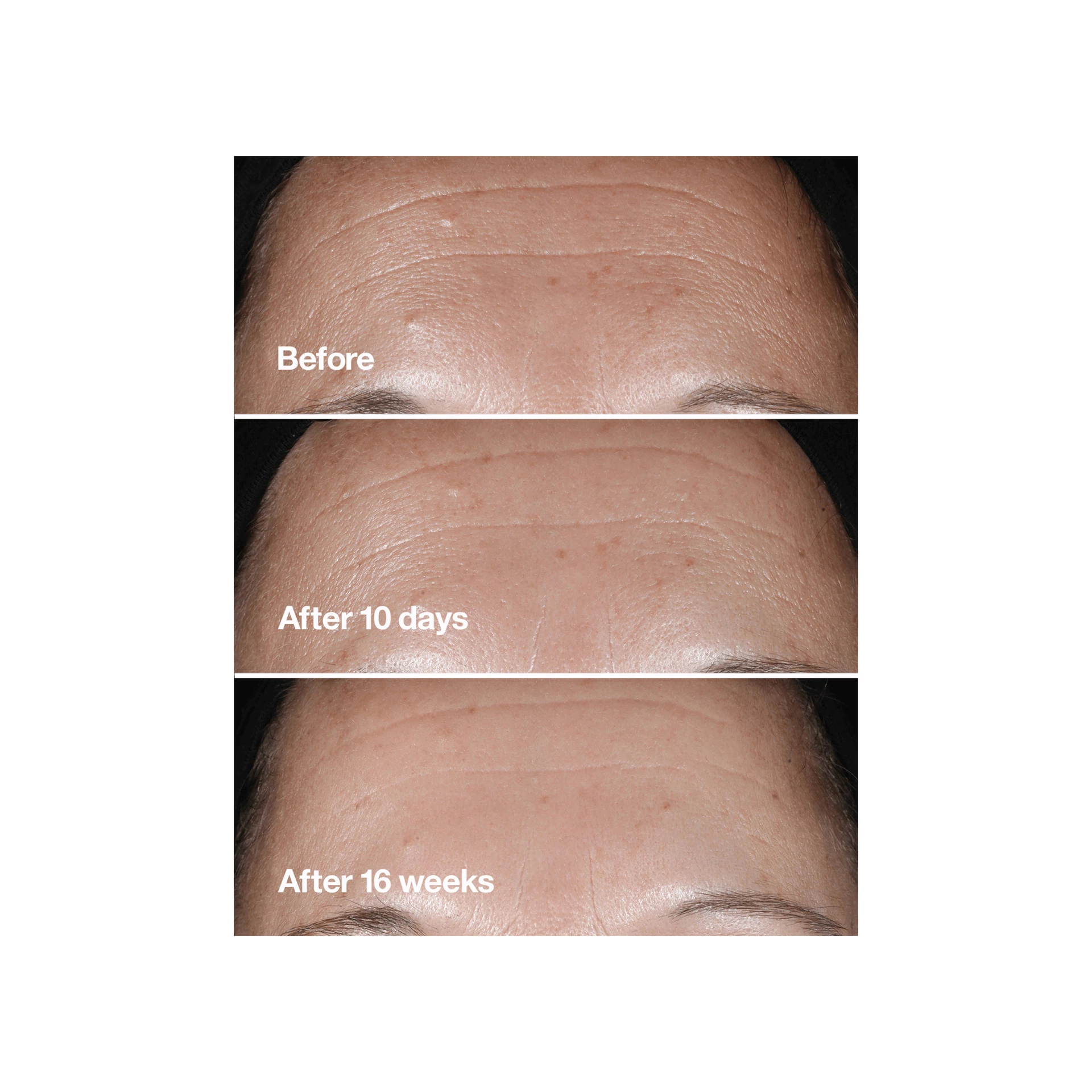 Smart Clinical Repair ránctalanító szérum 50 ml - Clinique