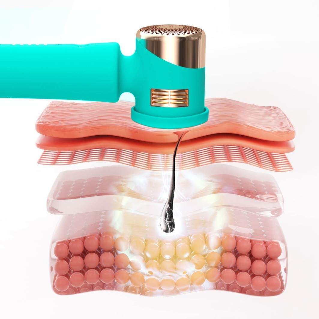 FOREO Epilator PEACH™ 2 - 1 komad