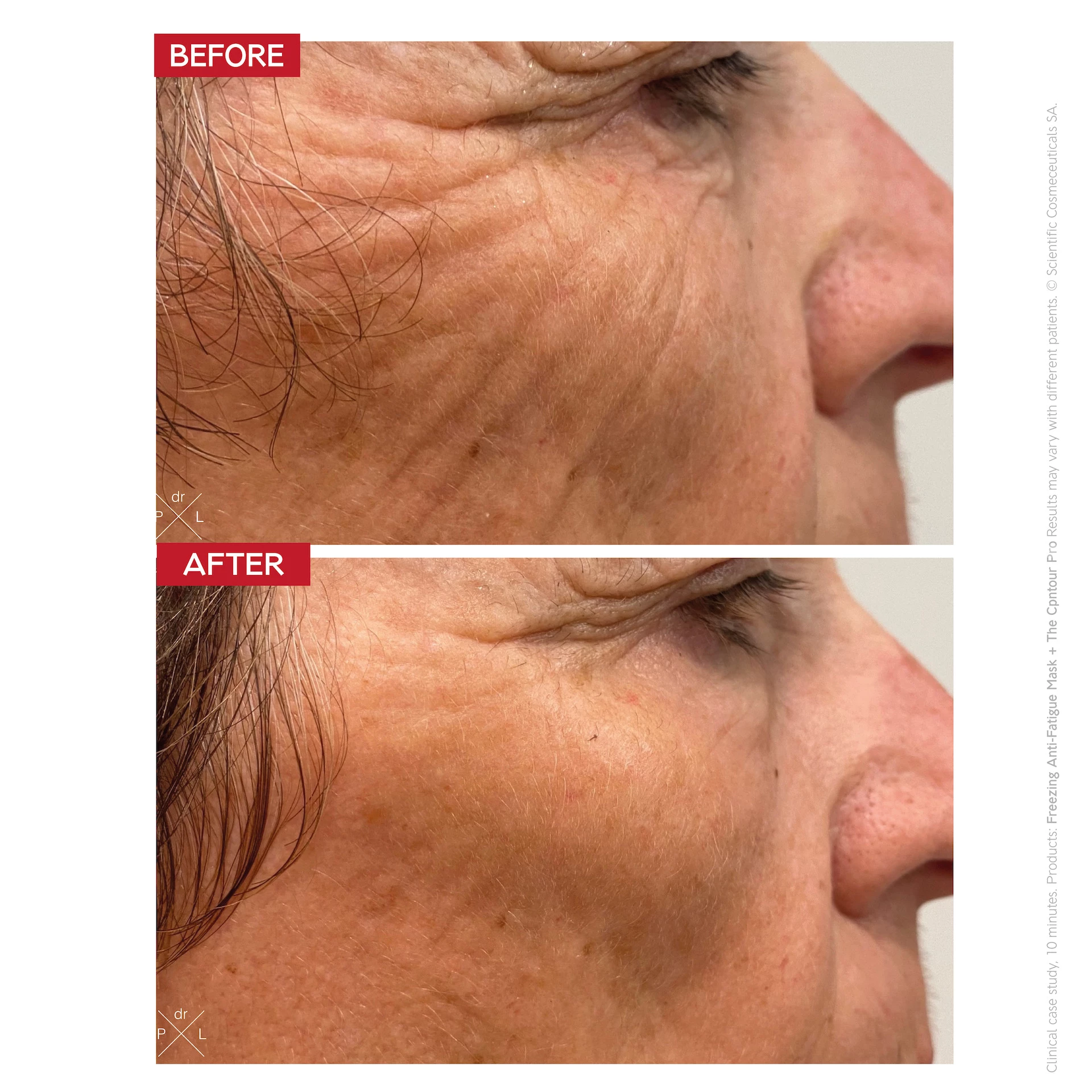 A Contour Pro - Dr. LEVY Svájc