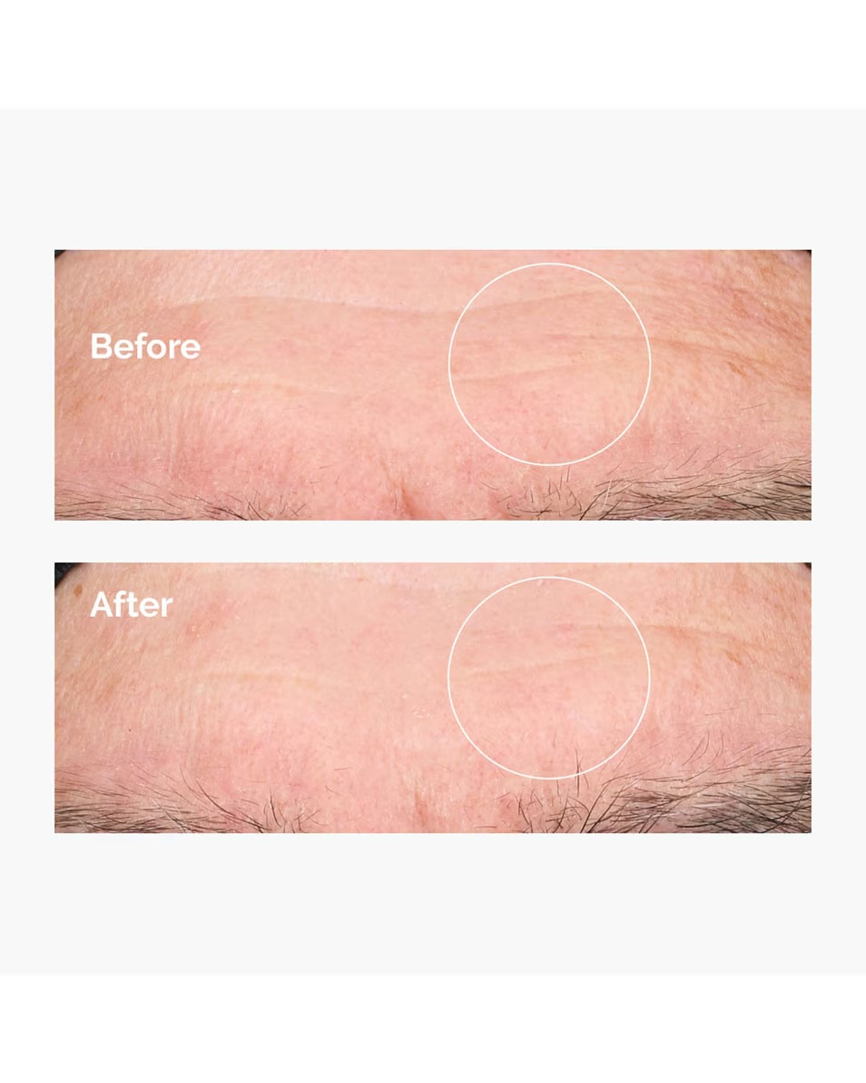THE ORDINARY Uscăciune și deshidratare Acid hialuronic 2% B5
