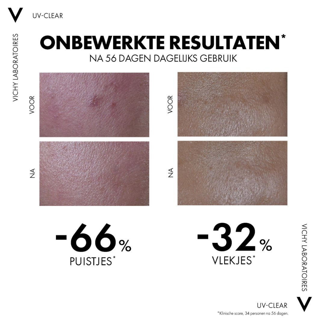 Vichyjeva krema za sončenje Capital Soleil UV-Clear SPF 50+ - 40 ml