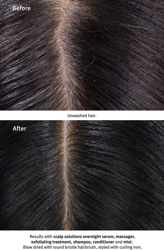 Aveda Scalp Solutions Exfoliating Scalp Treatment piling gel za regeneracijo lasišča
