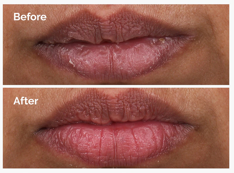 Sérum labial esfoliante com 5% de PHA da The Ordinary