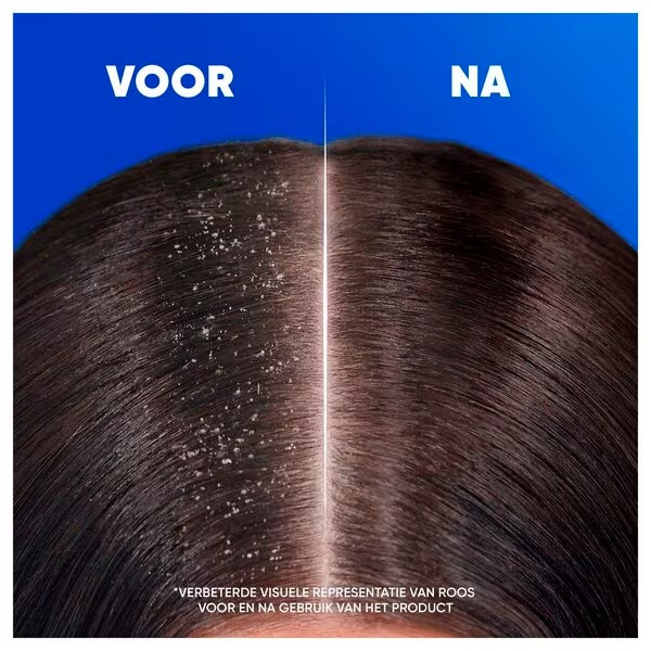 Šampón proti lupinám Head & Shoulders Menthol Fresh 2 v 1<br>300ml - Pre všetky typy vlasov a pokožky hlavy
