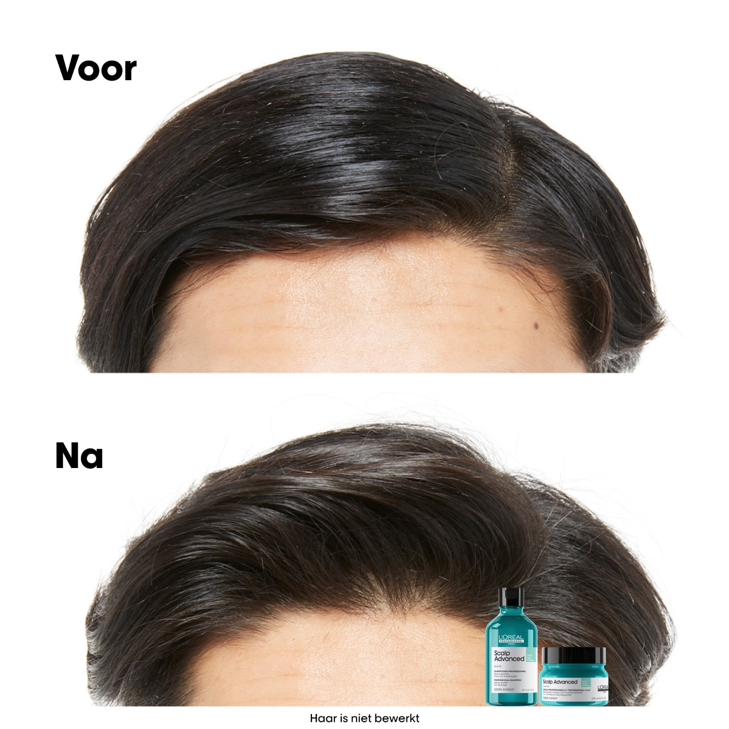 L'Oréal Professionnel Hair Shampoo Scalp Advanced Anti-Filiness Dermo-Cleanser - 300 ml