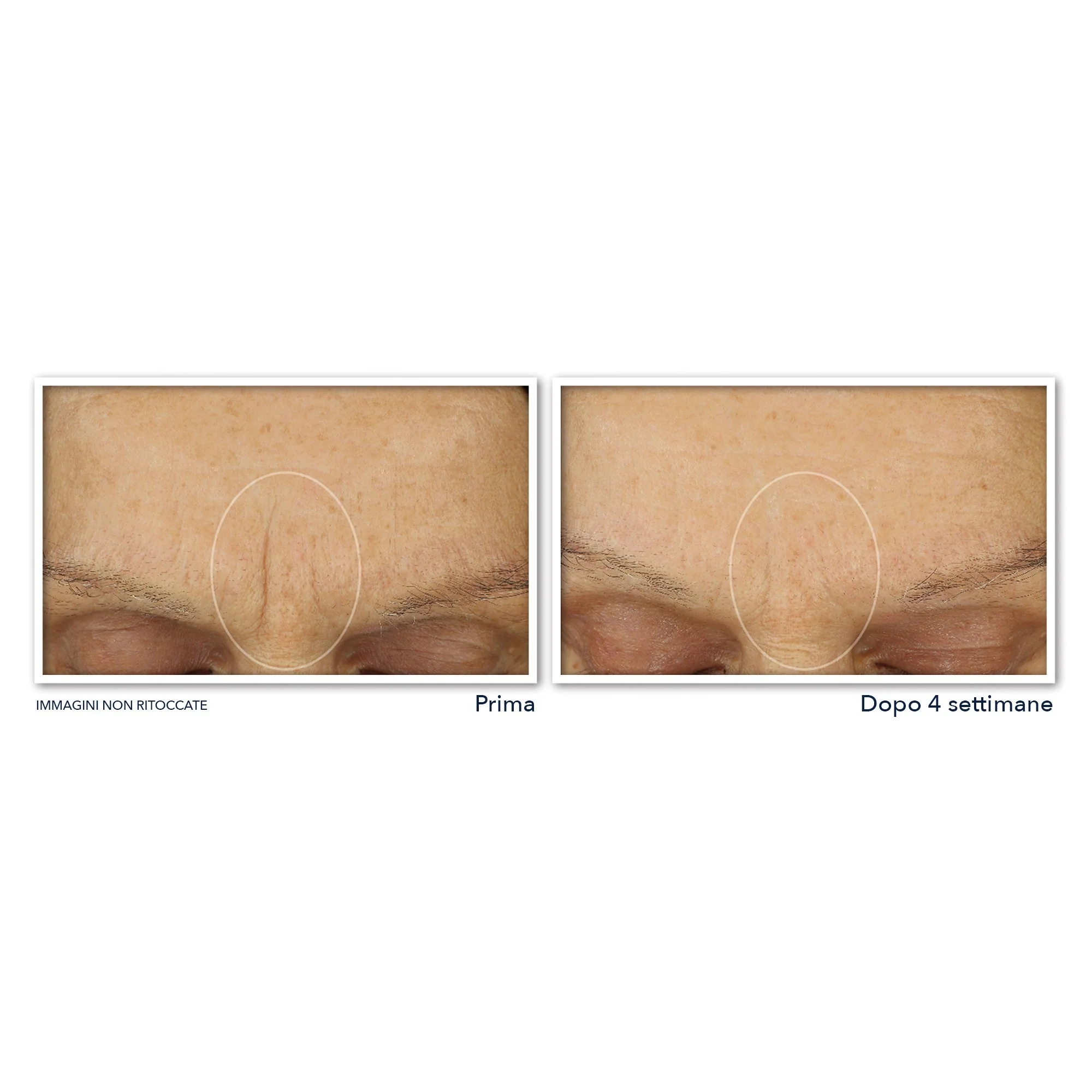 Retinol Correxion Line Smoothing Crema Viso Massima Idratazione - Tratt.viso 24 ore antirughe