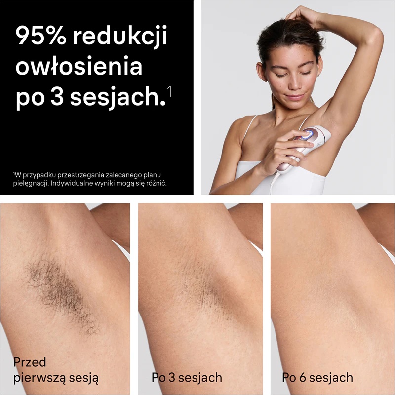 „Braun Smart IPL Skin i·expert PL7432“ išmanusis IPL plaukų šalinimo prietaisas kūnui, veidui, bikinio sričiai ir pažastims