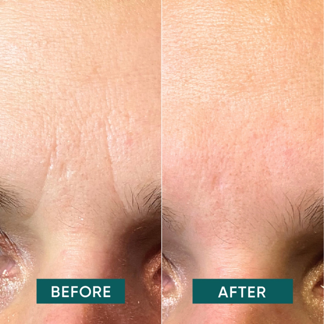 Abrikoos anti-aging gezichtsmasker van katoen met hyaluronzuur – 100 stuks – 1 stuk