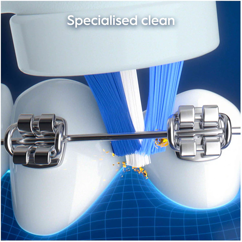Escova de dentes elétrica Oral-B iO My Way com estojo