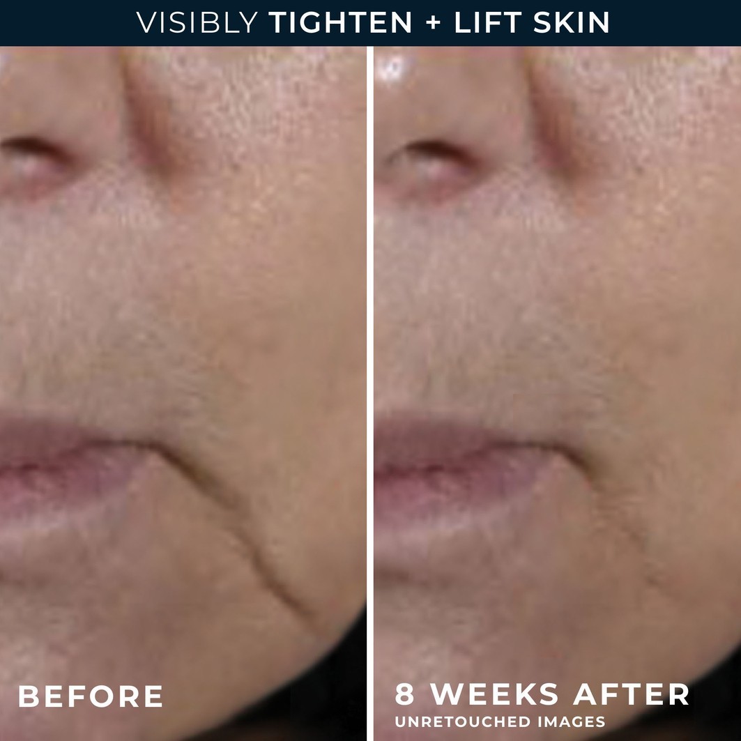 RoC sejas krēms Multi Correxion Firm+Lift Anti-Sagging stiprinošs krēms - 50 ml