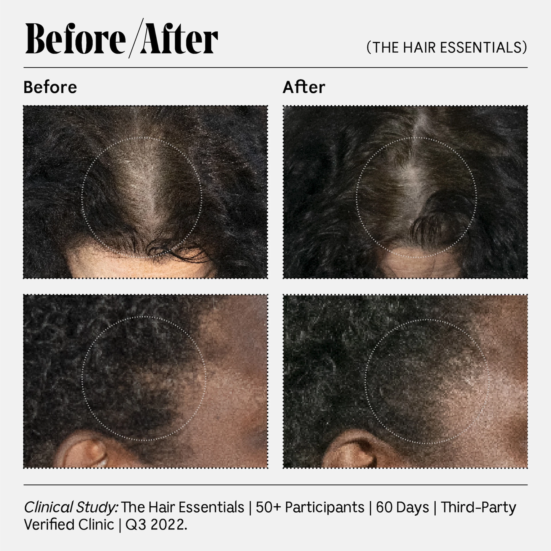 The Scalp Serum Illatmentes 100 ml - Nécessaire