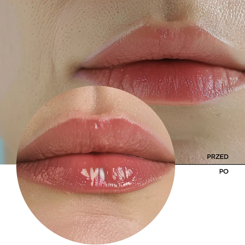Revox B77 Lip Filler, um bálsamo labial hidratante com ácido hialurônico para dar volume aos lábios.