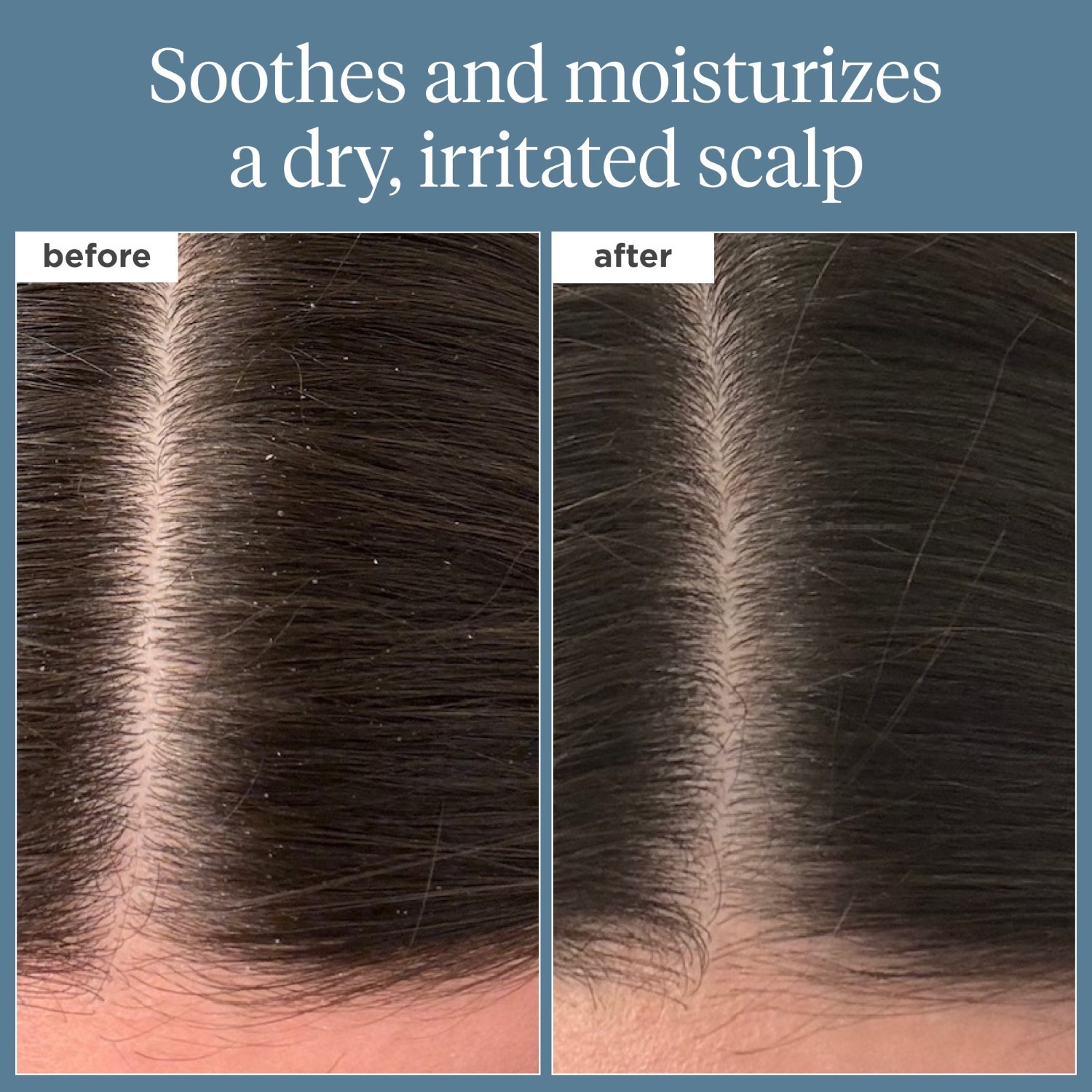 Briogeo Scalp Care Scalp Revival™ Rozmarínový predumyvací olej na vlasy a pokožku hlavy – 100 ml