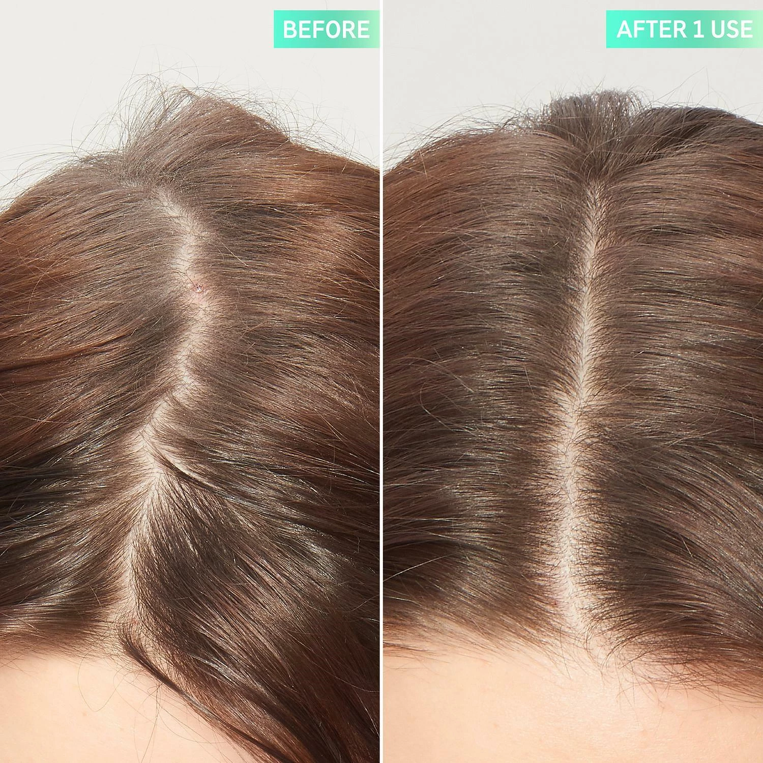 Exfoliant pentru scalp cu acid glicolic - Lista INKEY
