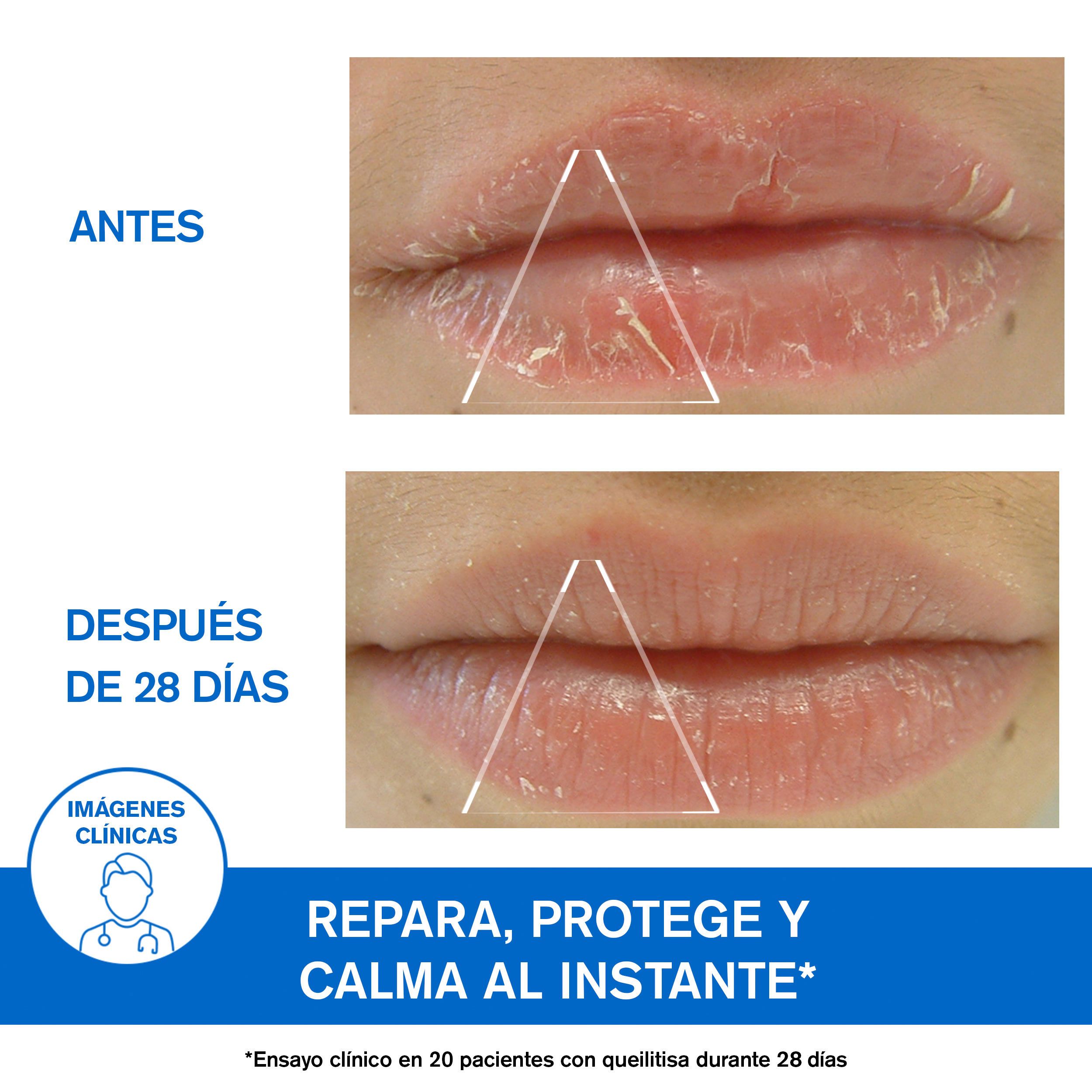 Bariéderm CICA zaštitni balzam za usne Kozmetika za lice iz ljekarne