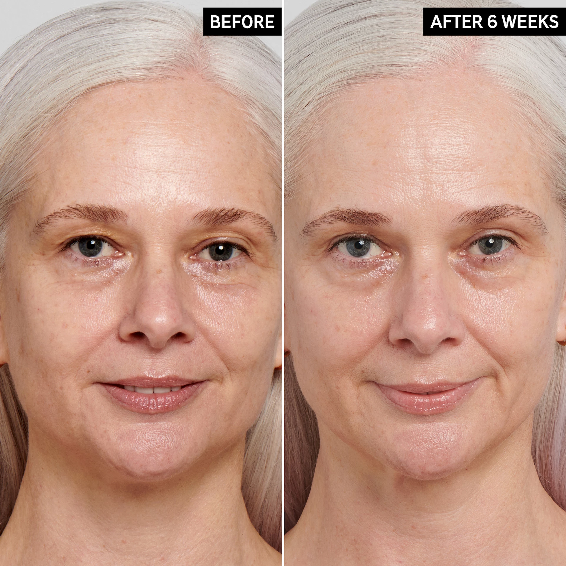 Retinol Serum - INKEY lista