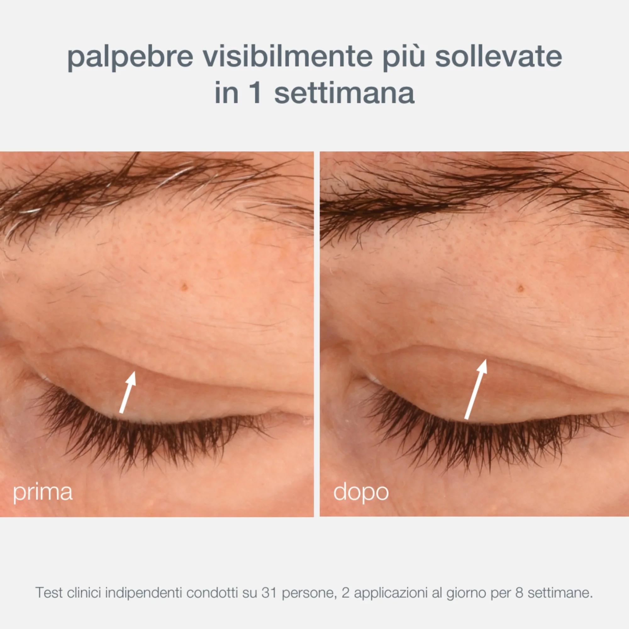 Phyto Nature Phyto Nature Lifting Eye Cream - Contorno occhi antirughe
