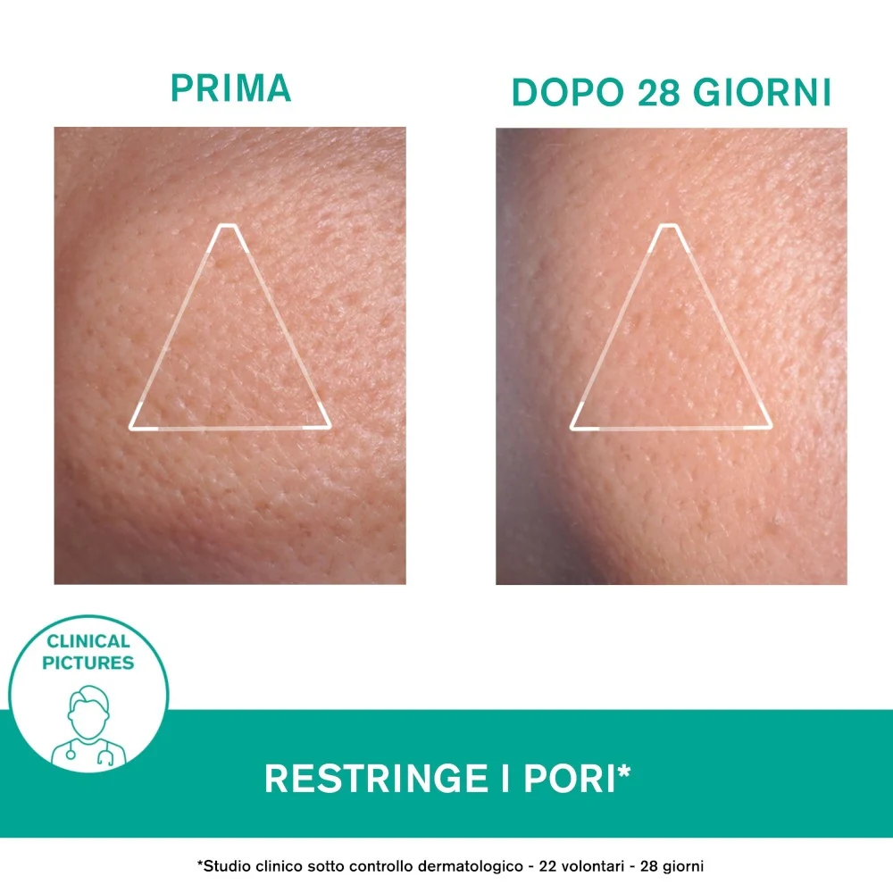 HYSÉAC Mat Trattamento Opacizzante - Gel viso antimperfezioni, Tratt.viso 24 ore antimperfezioni