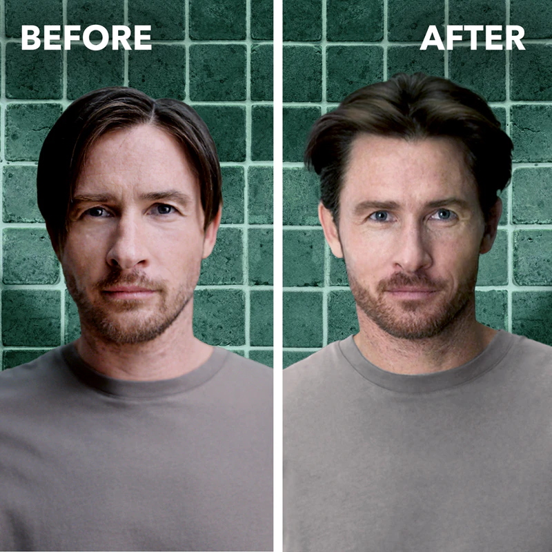 Schwarzkopf Schauma Hair Booster Tônico Capilar com Cafeína para Cabelos Fracos e com Queda