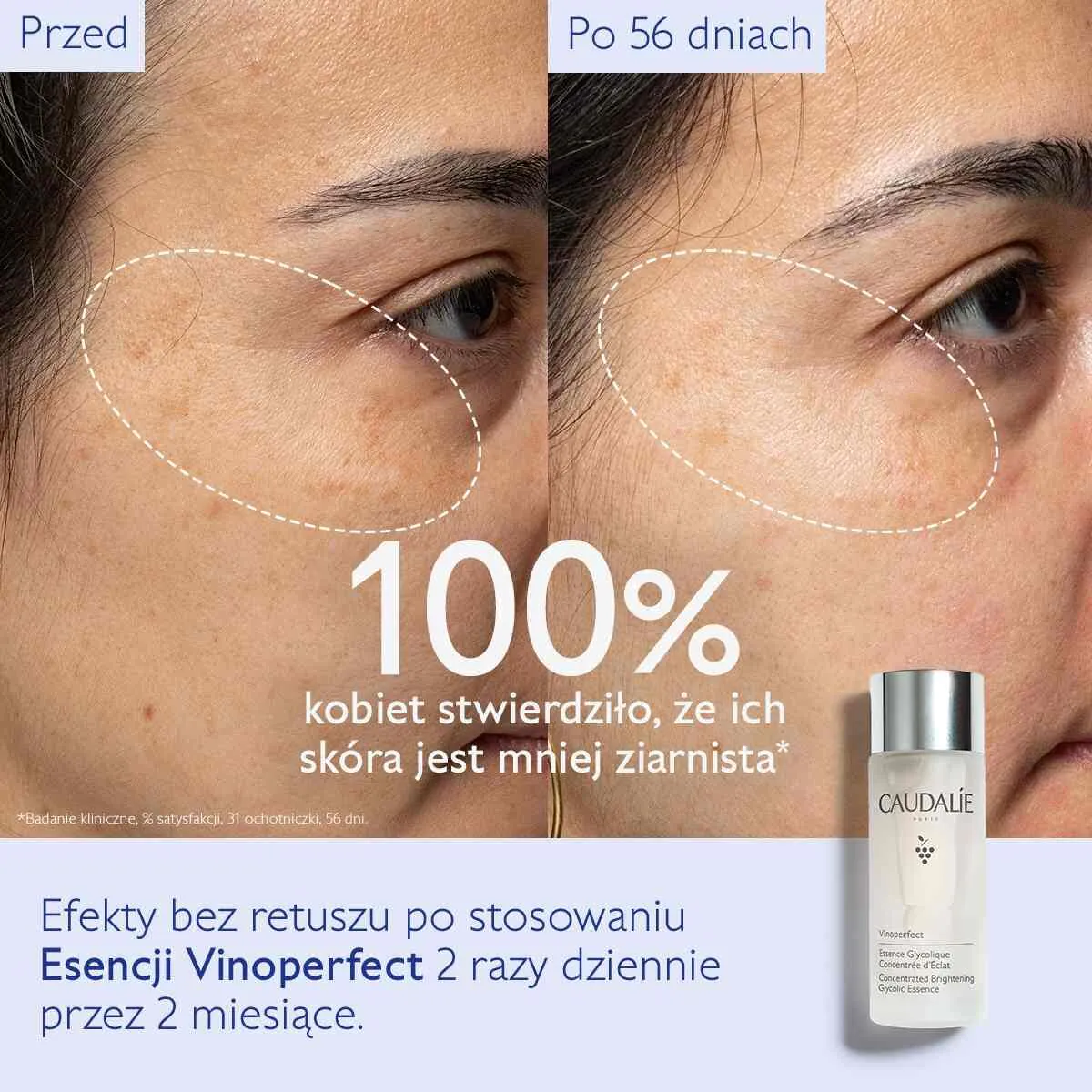 Caudalie Vinoperfect Skoncentrowana glikolowa esencja dodająca blasku