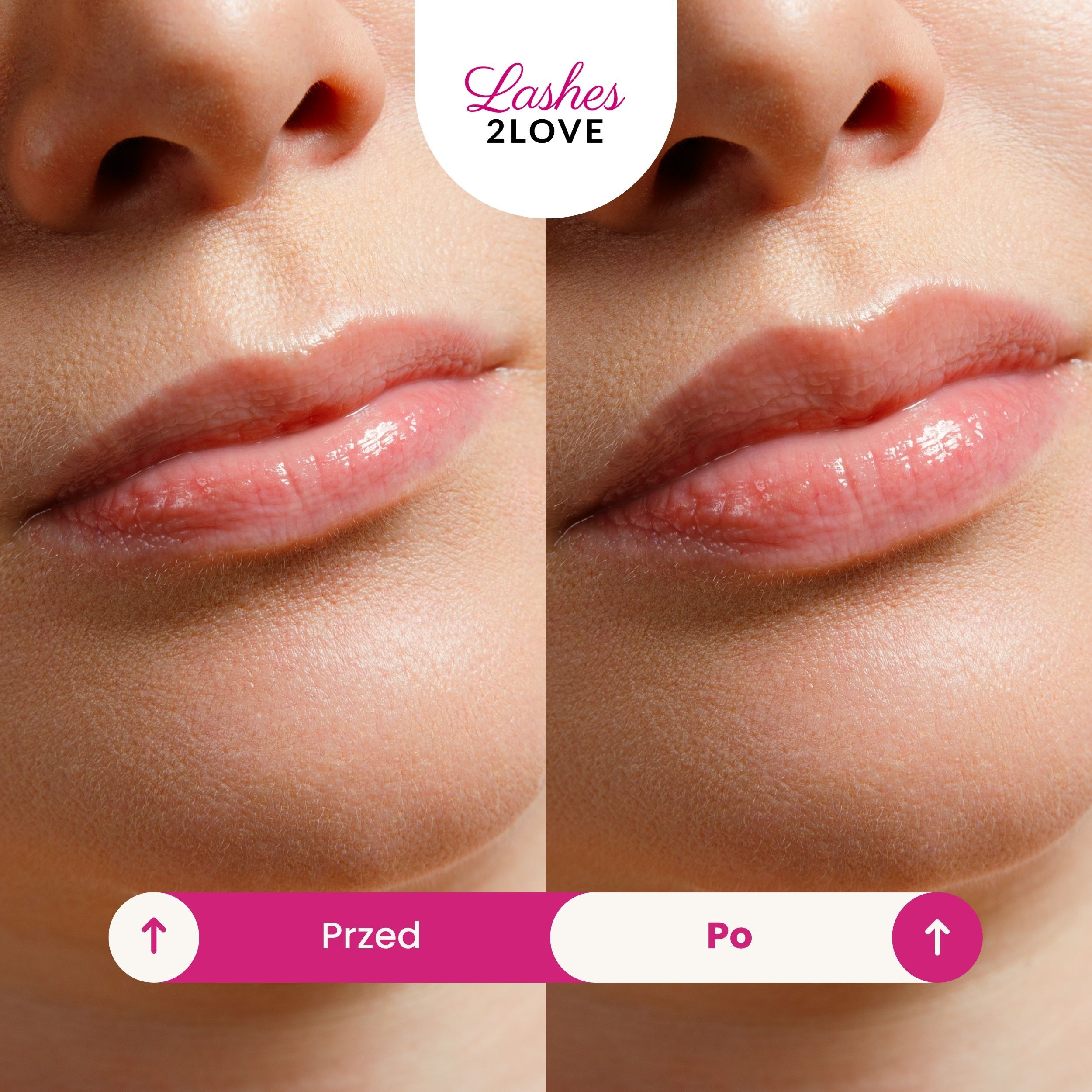 Inveo Lips2Love