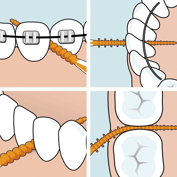 TePe Easypick interdentalne četkice veličine XS/S, 36 komada
